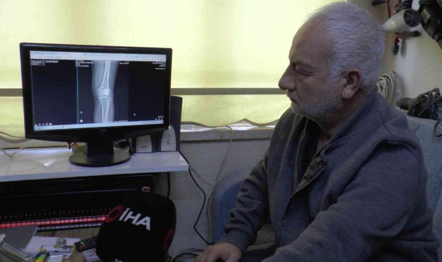 Diz kapağındaki mermi 13 gün sonra fark edildi