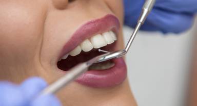 Dental Tedaviler Hakkında Bilinmesi Gerekenler